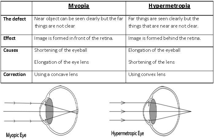 Notes And Questions For NCERT Class 10 Science Human Eyes and Colourful World